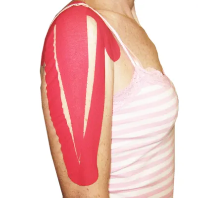Kinesiotaping, fotka 2