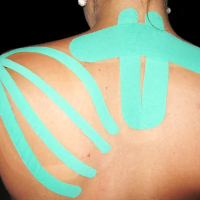 Kinesiotaping, fotka 3